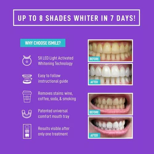 iSmile Kit instructions and directions
